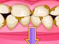 play Bad Teeth Makeover game