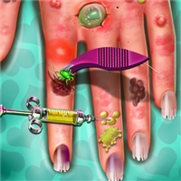 play Hand Skin Doctor game