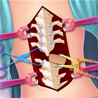 play Anna Scoliosis Surgery game