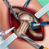 play Ella Hip Surgery game